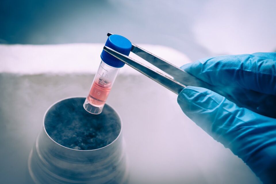 Fertility preservation Fertility preservation, freezing eggs, oocytes