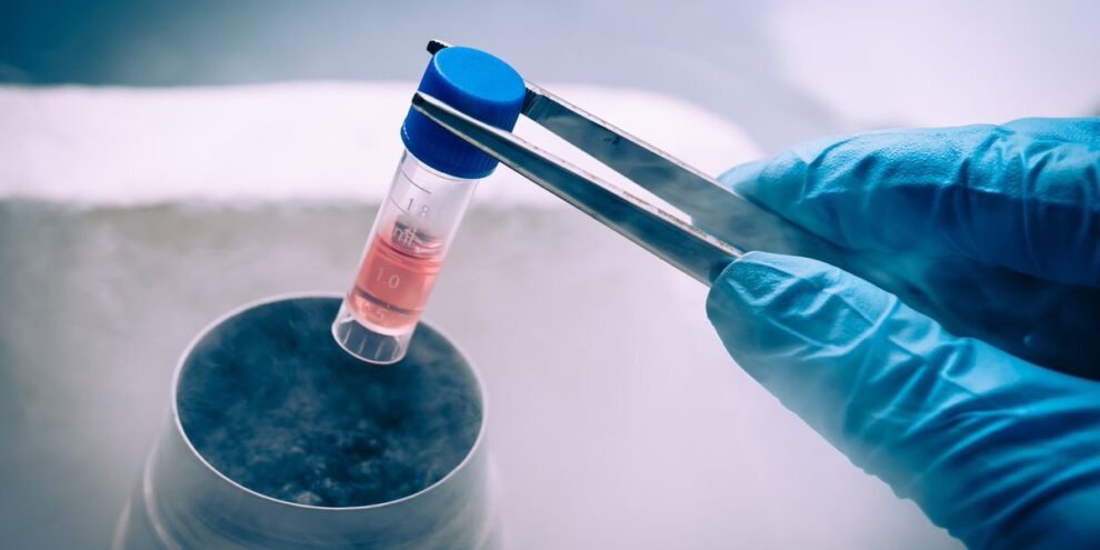 Fertility preservation, freezing eggs, oocytes